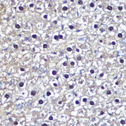 Anti-Thymidine Kinase 1 antibody used in IHC (Paraffin sections) (IHC-P). GTX33544