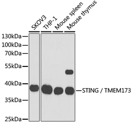 Anti-STING antibody used in Western Blot (WB). GTX33549