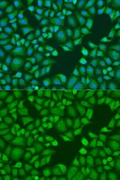 Anti-TNRC6A antibody used in Immunocytochemistry/ Immunofluorescence (ICC/IF). GTX33551