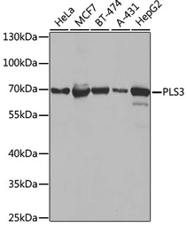 Anti-T-Plastin antibody used in Western Blot (WB). GTX33552