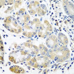 Anti-T-Plastin antibody used in IHC (Paraffin sections) (IHC-P). GTX33552