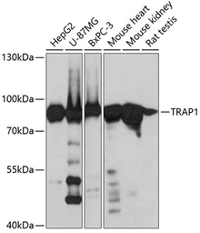 Anti-TRAP1 antibody used in Western Blot (WB). GTX33558