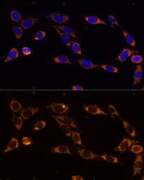 Anti-TRAP1 antibody used in Immunocytochemistry/ Immunofluorescence (ICC/IF). GTX33558