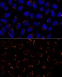 Anti-TRAP1 antibody used in Immunocytochemistry/ Immunofluorescence (ICC/IF). GTX33558