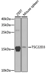 Anti-GILZ antibody used in Western Blot (WB). GTX33560