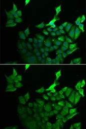 Anti-GILZ antibody used in Immunocytochemistry/ Immunofluorescence (ICC/IF). GTX33560