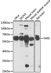 Anti-Tyrosyl tRNA synthetase antibody used in Western Blot (WB). GTX33565