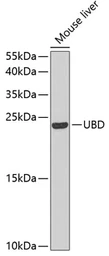 Anti-FAT10 antibody used in Western Blot (WB). GTX33566