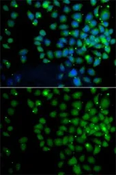 Anti-FAT10 antibody used in Immunocytochemistry/ Immunofluorescence (ICC/IF). GTX33566