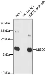 Anti-UBE2C antibody used in Immunoprecipitation (IP). GTX33567