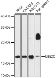 Anti-UBE2C antibody used in Western Blot (WB). GTX33567