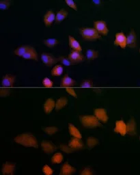 Anti-UBE2C antibody used in Immunocytochemistry/ Immunofluorescence (ICC/IF). GTX33567