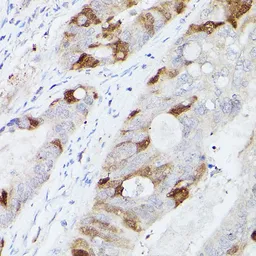 Anti-UBE2C antibody used in IHC (Paraffin sections) (IHC-P). GTX33567