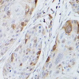 Anti-UBE2C antibody used in IHC (Paraffin sections) (IHC-P). GTX33567