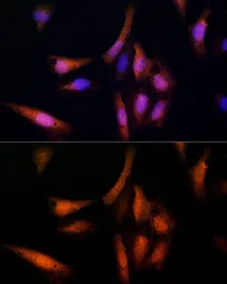 Anti-UBE2C antibody used in Immunocytochemistry/ Immunofluorescence (ICC/IF). GTX33567