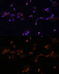 Anti-UBE2L3 antibody used in Immunocytochemistry/ Immunofluorescence (ICC/IF). GTX33568