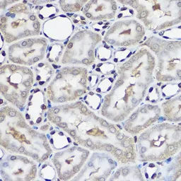 Anti-UBE2L3 antibody used in IHC (Paraffin sections) (IHC-P). GTX33568