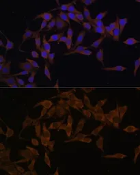 Anti-UBE2L3 antibody used in IHC (Paraffin sections) (IHC-P). GTX33568