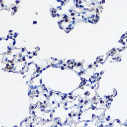 Anti-UBE2L3 antibody used in IHC (Paraffin sections) (IHC-P). GTX33568