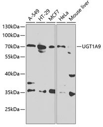 Anti-UGT1A9 antibody used in Western Blot (WB). GTX33571