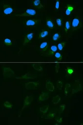 Anti-UGT1A9 antibody used in Immunocytochemistry/ Immunofluorescence (ICC/IF). GTX33571