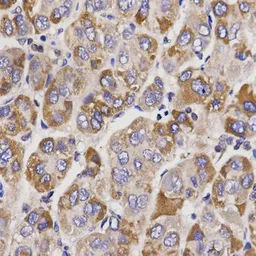 Anti-UGT1A9 antibody used in IHC (Paraffin sections) (IHC-P). GTX33571