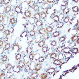 Anti-UQCRC1 antibody used in IHC (Paraffin sections) (IHC-P). GTX33572