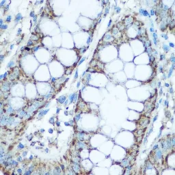 Anti-UQCRC2 antibody used in IHC (Paraffin sections) (IHC-P). GTX33573