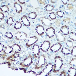 Anti-UQCRC2 antibody used in IHC (Paraffin sections) (IHC-P). GTX33573