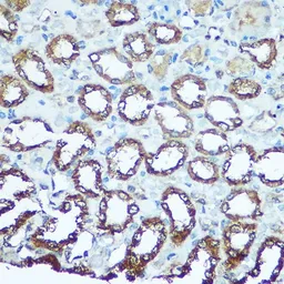 Anti-UQCRFS1 antibody used in IHC (Paraffin sections) (IHC-P). GTX33574