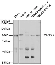 Anti-VANGL2 antibody used in Western Blot (WB). GTX33577