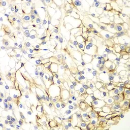 Anti-VANGL2 antibody used in IHC (Paraffin sections) (IHC-P). GTX33577