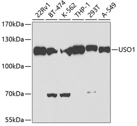 Anti-VDP / p115 antibody used in Western Blot (WB). GTX33578