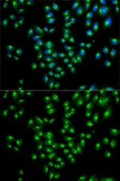 Anti-VDP / p115 antibody used in Immunocytochemistry/ Immunofluorescence (ICC/IF). GTX33578