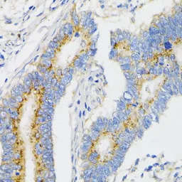 Anti-VDP / p115 antibody used in IHC (Paraffin sections) (IHC-P). GTX33578
