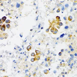 Anti-VDP / p115 antibody used in IHC (Paraffin sections) (IHC-P). GTX33578