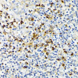Anti-VDP / p115 antibody used in IHC (Paraffin sections) (IHC-P). GTX33578