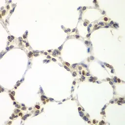 Anti-VRK1 antibody used in IHC (Paraffin sections) (IHC-P). GTX33581