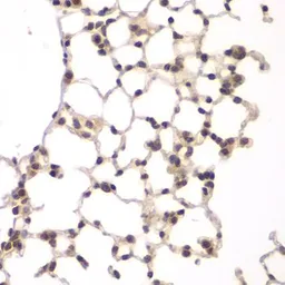 Anti-VRK1 antibody used in IHC (Paraffin sections) (IHC-P). GTX33581