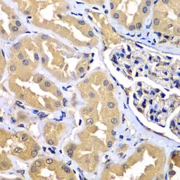 Anti-WIPI2 antibody used in IHC (Paraffin sections) (IHC-P). GTX33584
