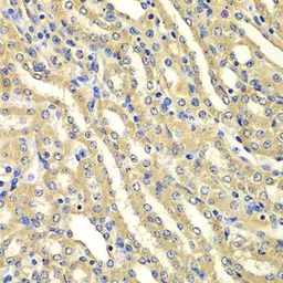 Anti-WIPI2 antibody used in IHC (Paraffin sections) (IHC-P). GTX33584