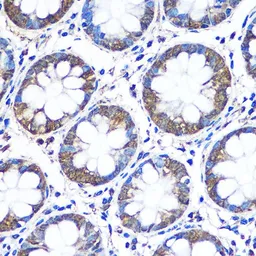 Anti-WISP2 antibody used in IHC (Paraffin sections) (IHC-P). GTX33585