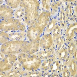 Anti-XIAP antibody used in IHC (Paraffin sections) (IHC-P). GTX33586