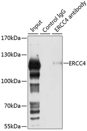 Anti-XPF antibody used in Immunoprecipitation (IP). GTX33587