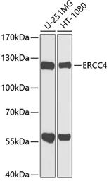 Anti-XPF antibody used in Western Blot (WB). GTX33587