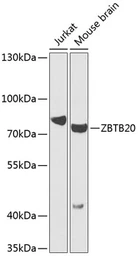 Anti-ZBTB20 antibody used in Western Blot (WB). GTX33588