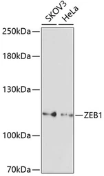Anti-ZEB1 antibody used in Western Blot (WB). GTX33589