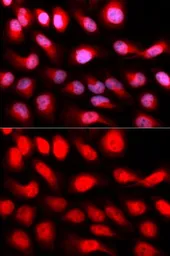 Anti-ZEB1 antibody used in Immunocytochemistry/ Immunofluorescence (ICC/IF). GTX33589