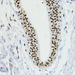 Anti-ZEB1 antibody used in IHC (Paraffin sections) (IHC-P). GTX33589