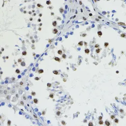Anti-ZEB1 antibody used in IHC (Paraffin sections) (IHC-P). GTX33589